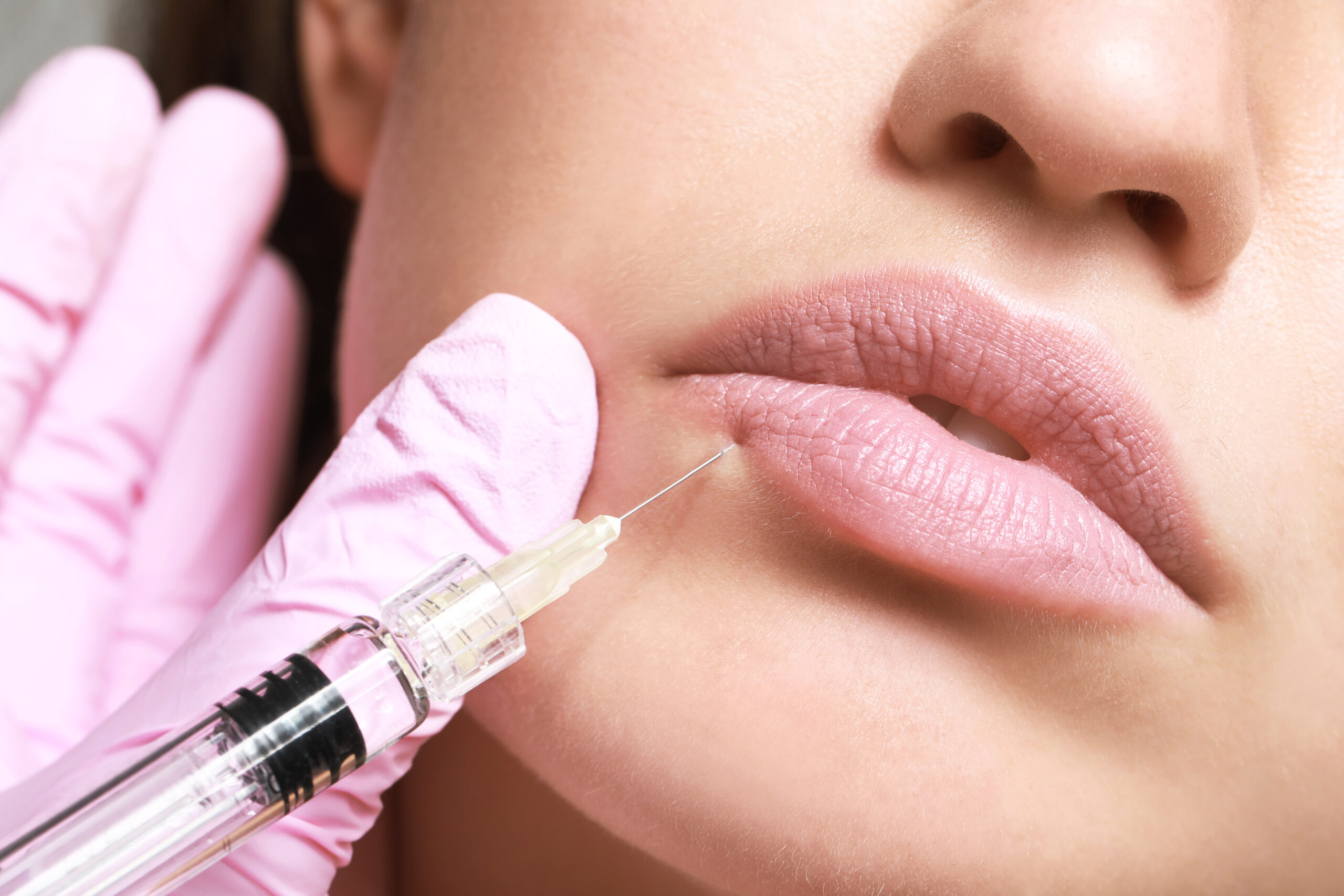Young,Woman,Receiving,Injection,Of,Filler,In,Lips,,Closeup