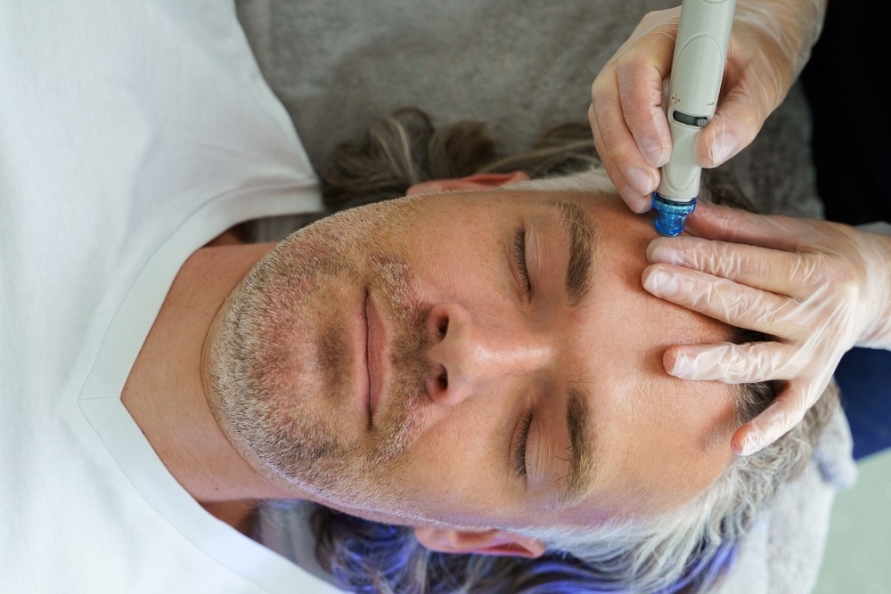 male patient receiving hydrafacial for facial inflammation