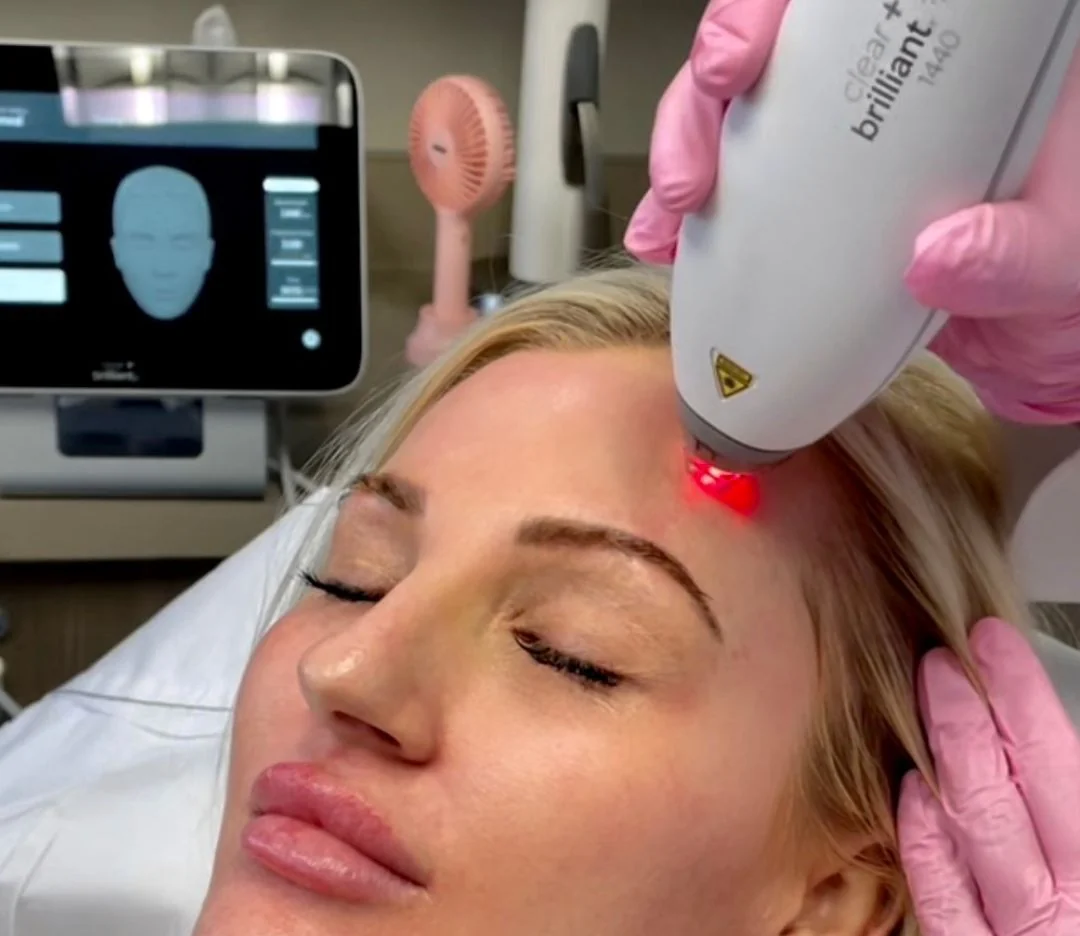 patient receiving Clear+Brilliant at Biospa