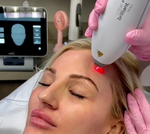 patient receiving Clear+Brilliant at Biospa